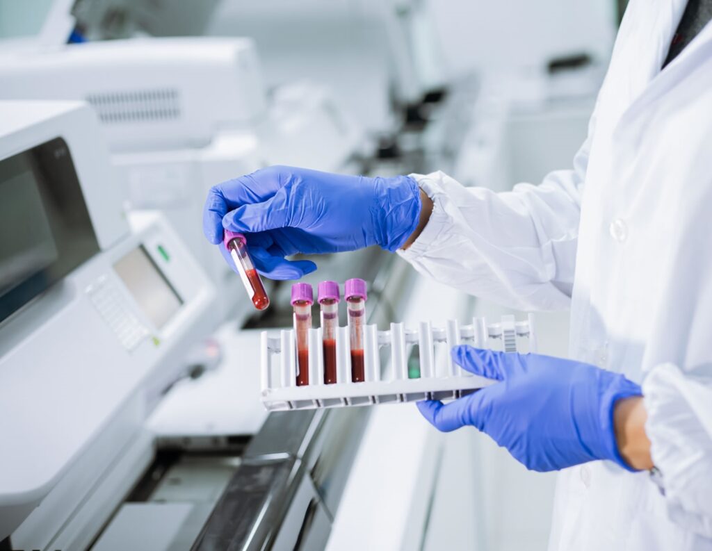 ¿Qué detecta una Biometría Hemática? Descubre lo que tu cuerpo revela en minutos 21 Laboratorio Clínico Analítica Biomedica