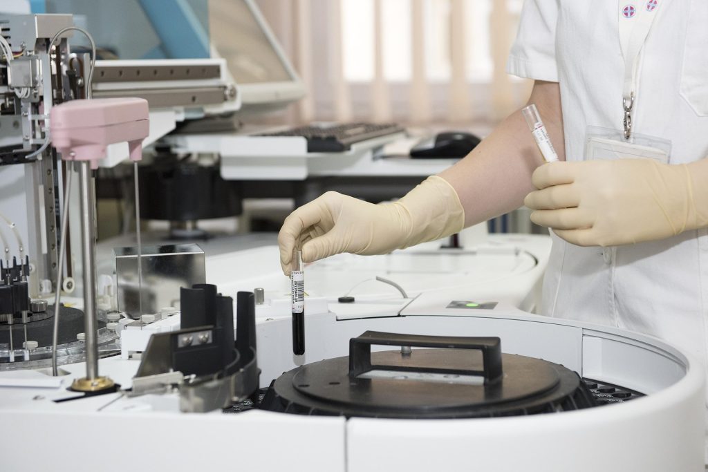 Principales exámenes de química sanguínea: guía completa para entender tus resultados 15 procesamiento de química sanguínea en laboratorio