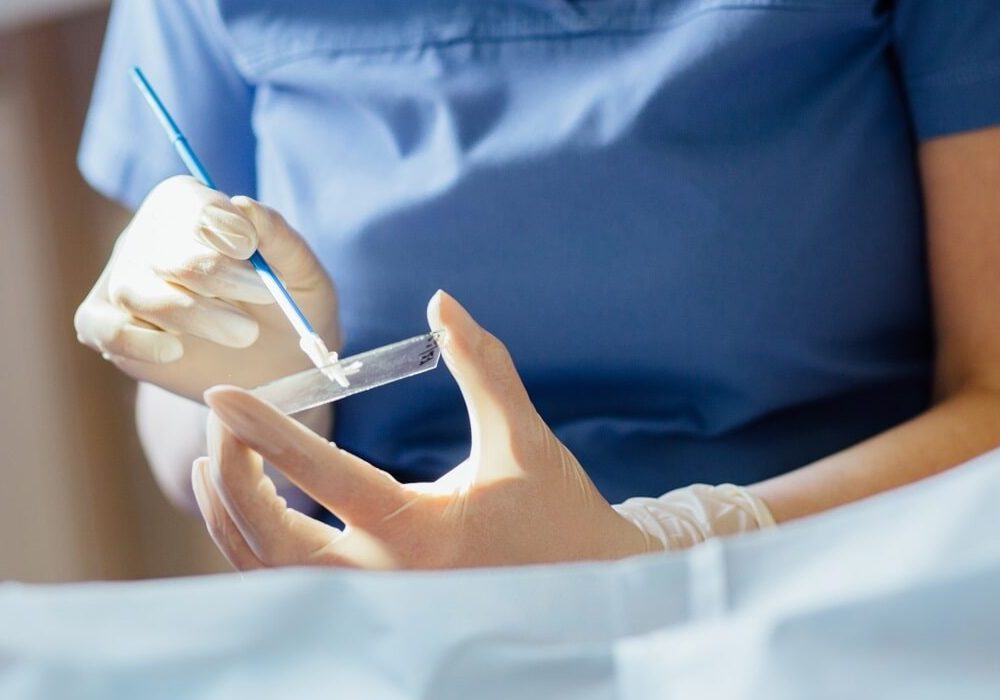 profesional anlizando muestra de citología