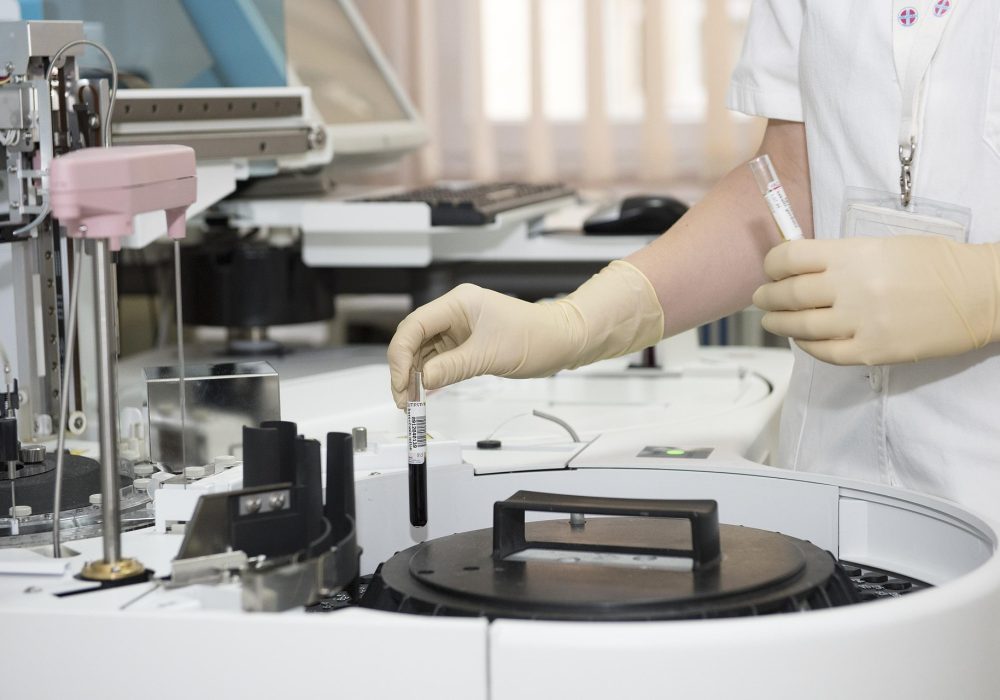 procesamiento de química sanguínea en laboratorio
